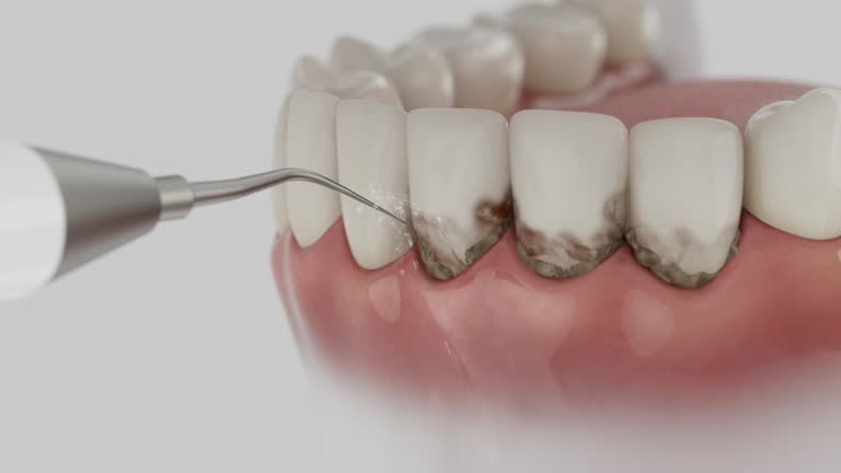 Trusted Emergency Dentist service in Bay Park, NY - Dentist Open Now